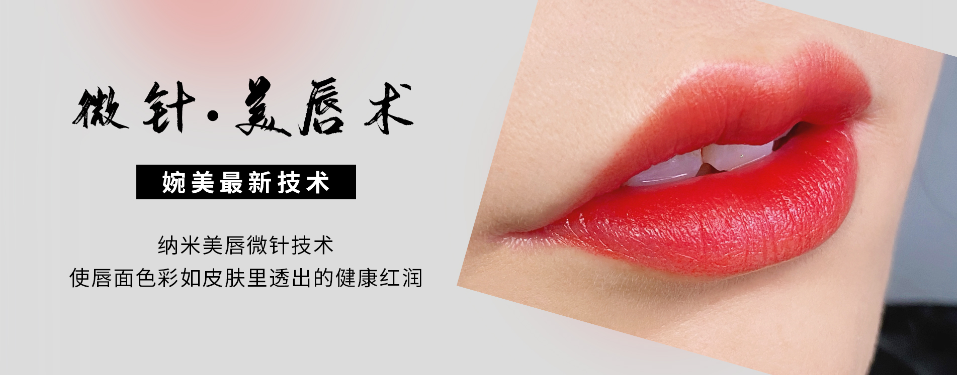 美唇术